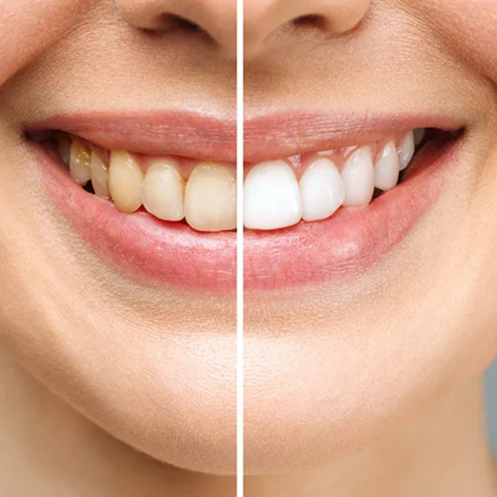 Cosmetic dentistry smile design